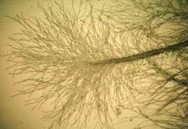Image | Tiny root "hairs" as small as .2 mm in diameter help trees absorb water and nutrients. Image courtesy gibneyCE.com
